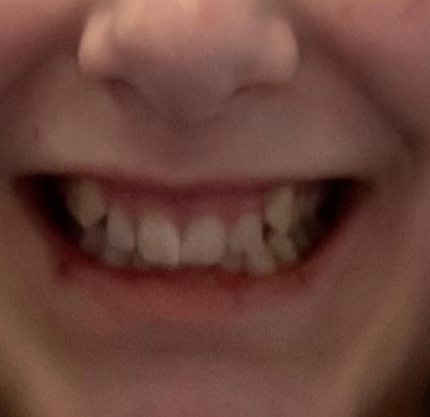Teeth