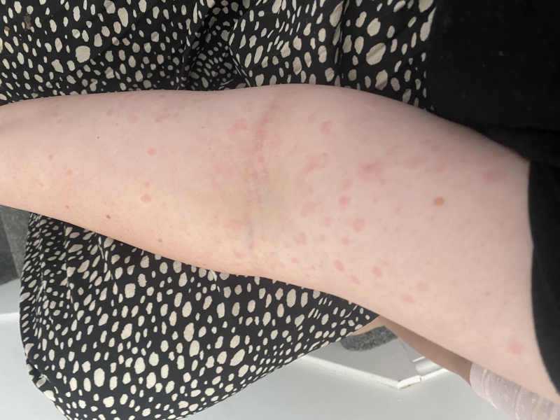 Weird rash
