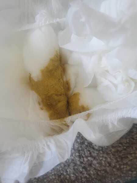 3 Week Old Watery Poos to Mustardy Green? Is this normal??