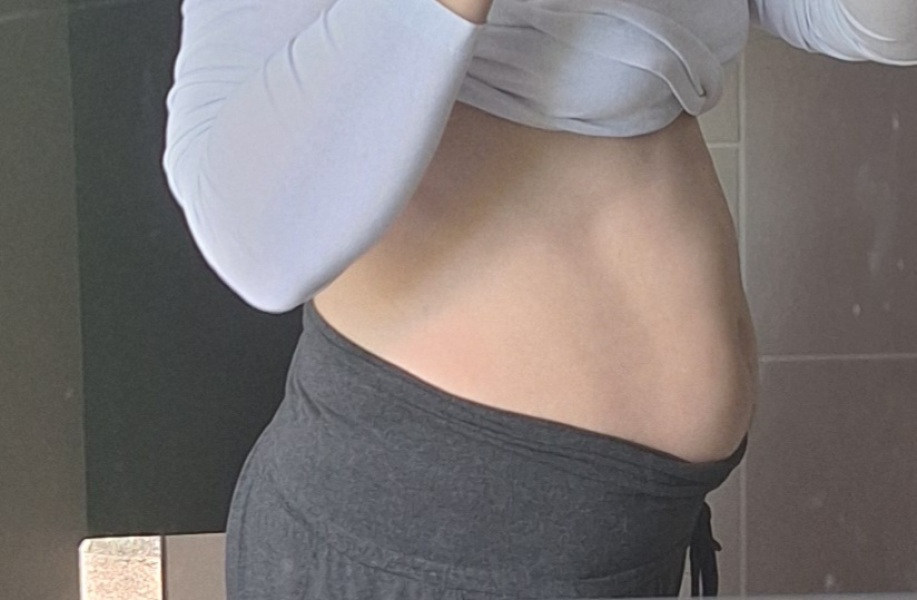 Can you be tired for 1,5 years, have bloating and it is not cancer?
