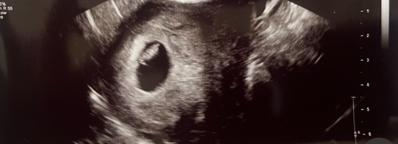 Due Jan 2025