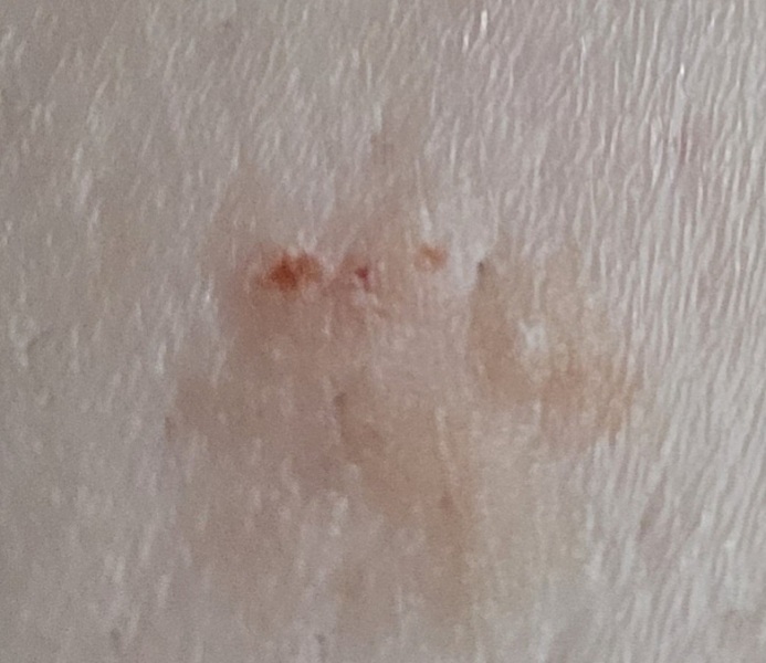 Can anyone advise me on what this might be?