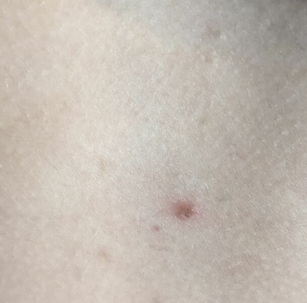 What is this on DS11's chest