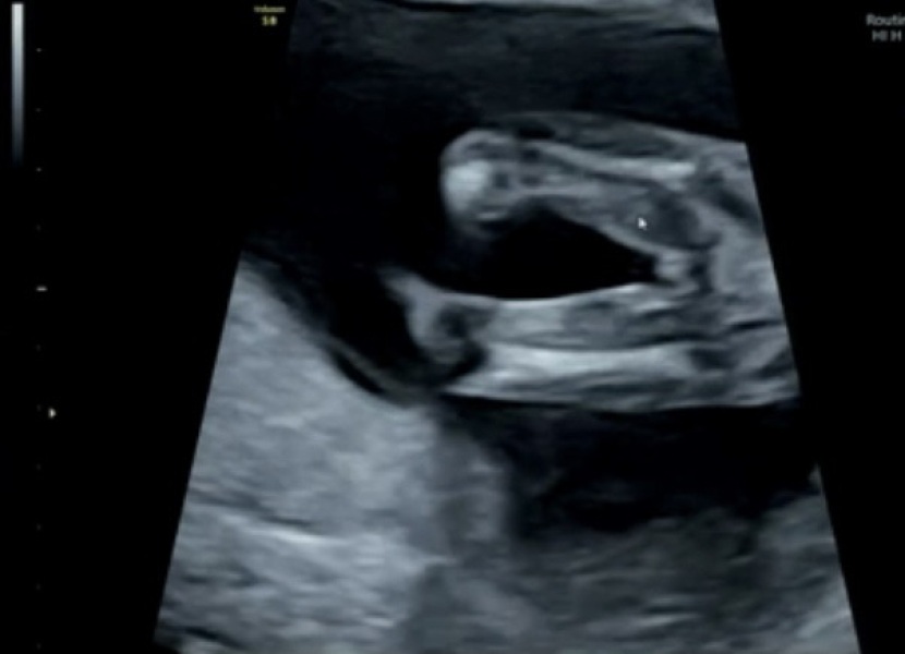 Gender ?
