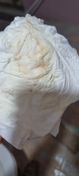 TTC after Miscarriage part 4