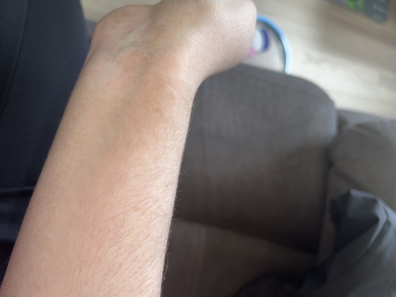 Brown stuff on skin