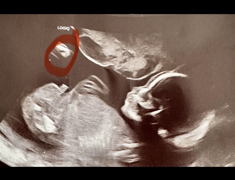 Have I ruined the gender surprise? :(