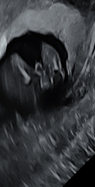 Is this a penis?