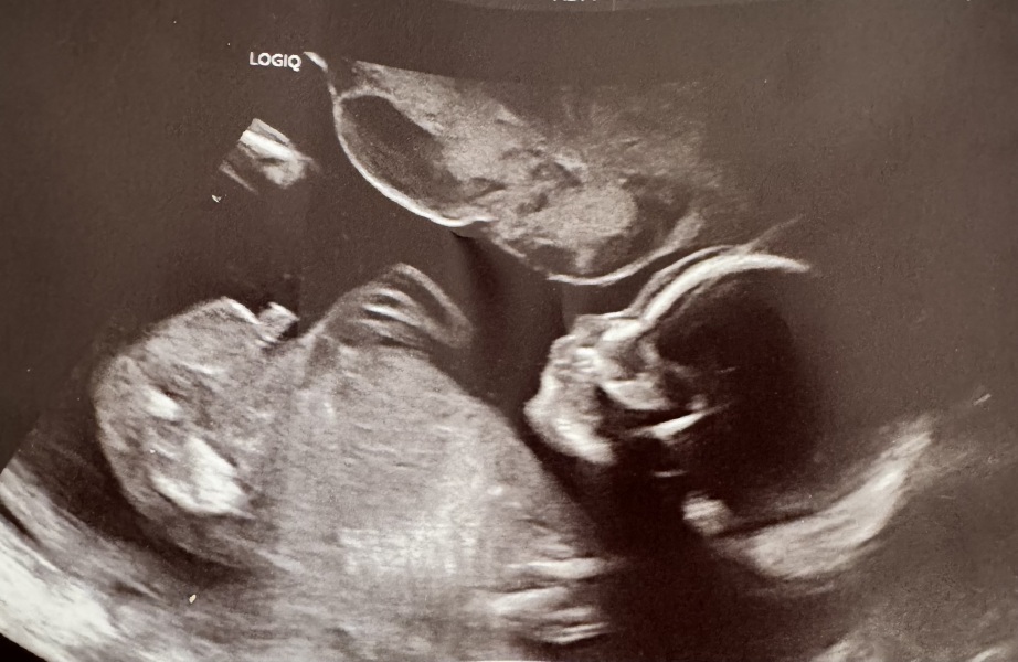 Have I ruined the gender surprise? :(
