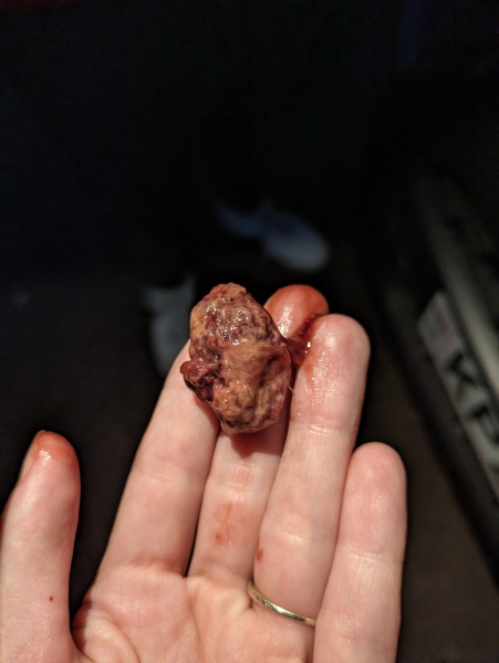 What has come out of my vagina?!