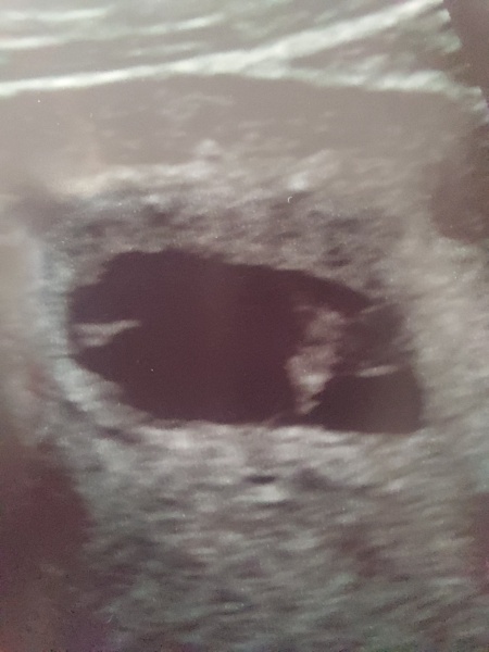 Due February 2025