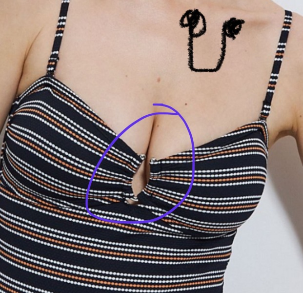 What is this called?