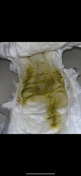 Changes in baby’s poo - normal for 5 weeks old? **TW photos of poo attached**