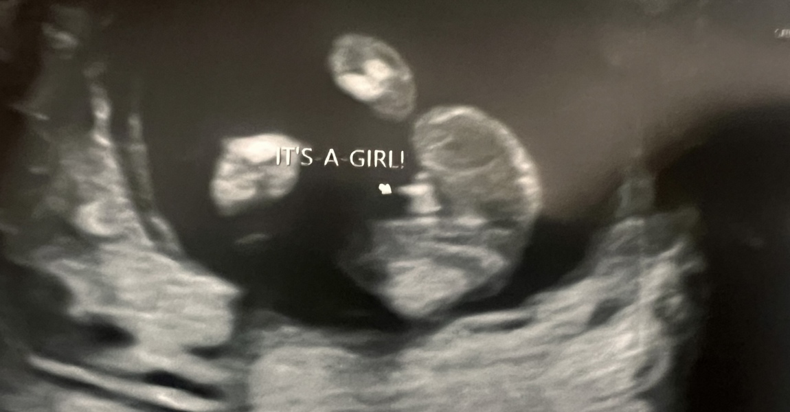 Told it’s a girl, convinced it’s a boy lol