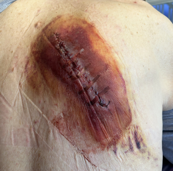 Please help. Just found this on my dad's back.