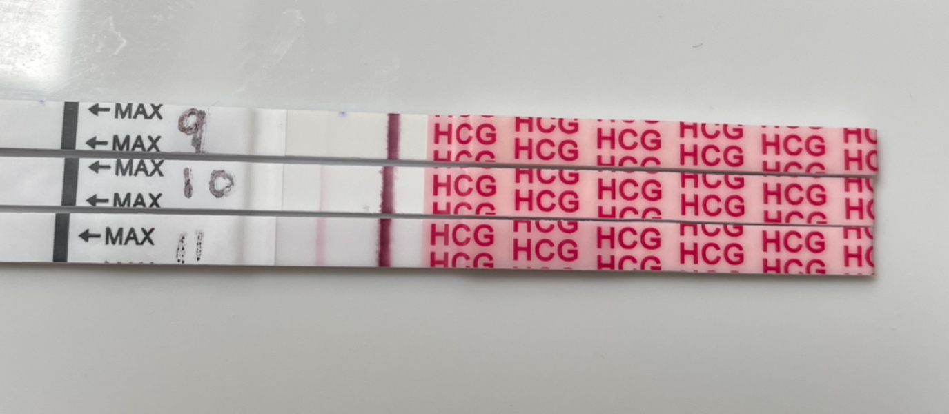 Just a little advice