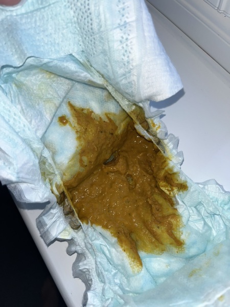 Is this still diarrhea?