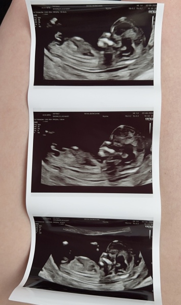 Boy or girl ?