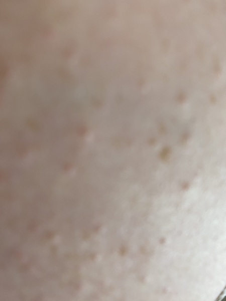 What’s this on my chest