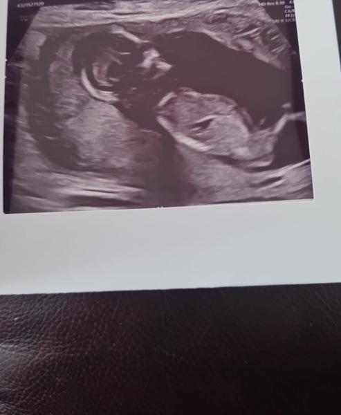 Potty shot @ 15 weeks, is it a boy???