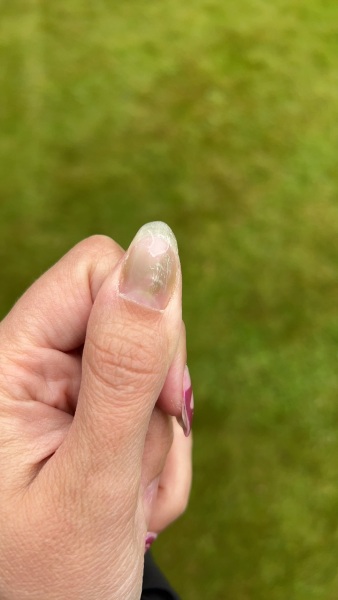 Help - nails
