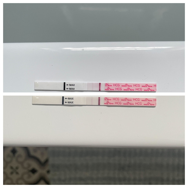 Any hope for poor line progression? Or should I resign myself to a chemical?