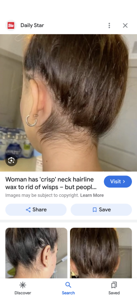 Hairy neck!