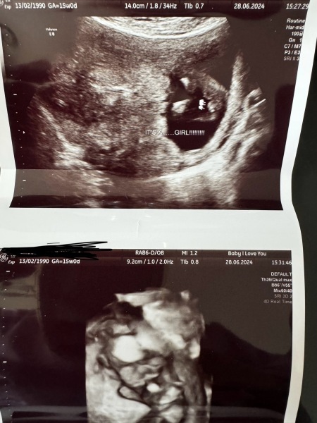 Is this definitely a girl?