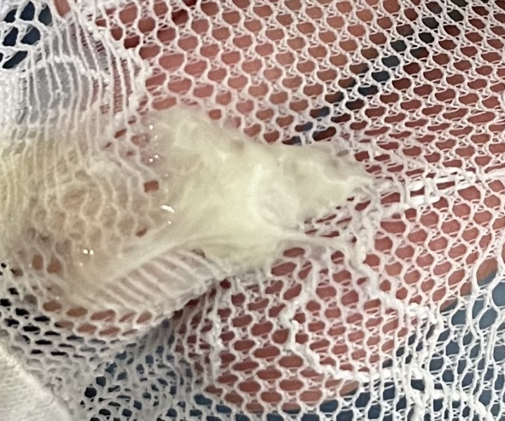 (TMI!) Is this my mucous plug? (36+4)