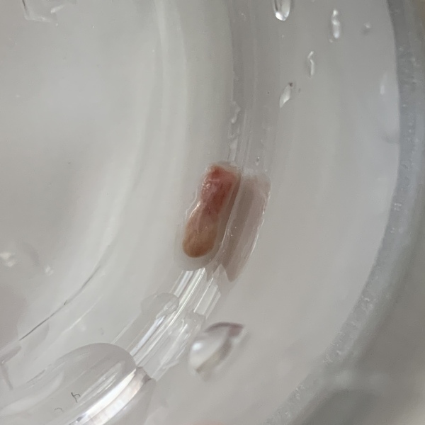 Passed tissue @ 9 weeks