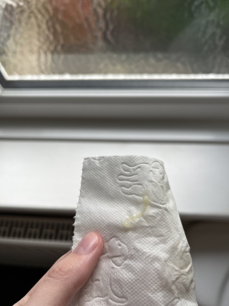 Lost a bit of my mucus plug at 26 weeks? (TMI IMAGE)