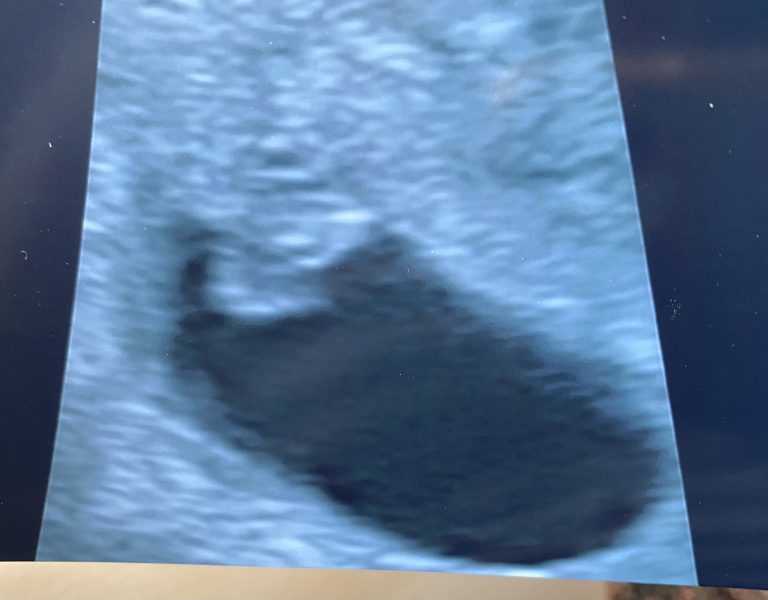 Due February 2025