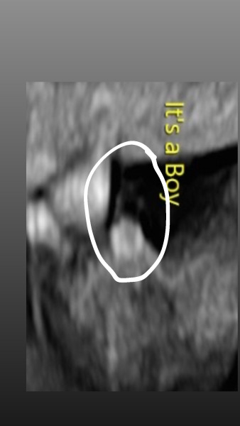 15.5 week gender help