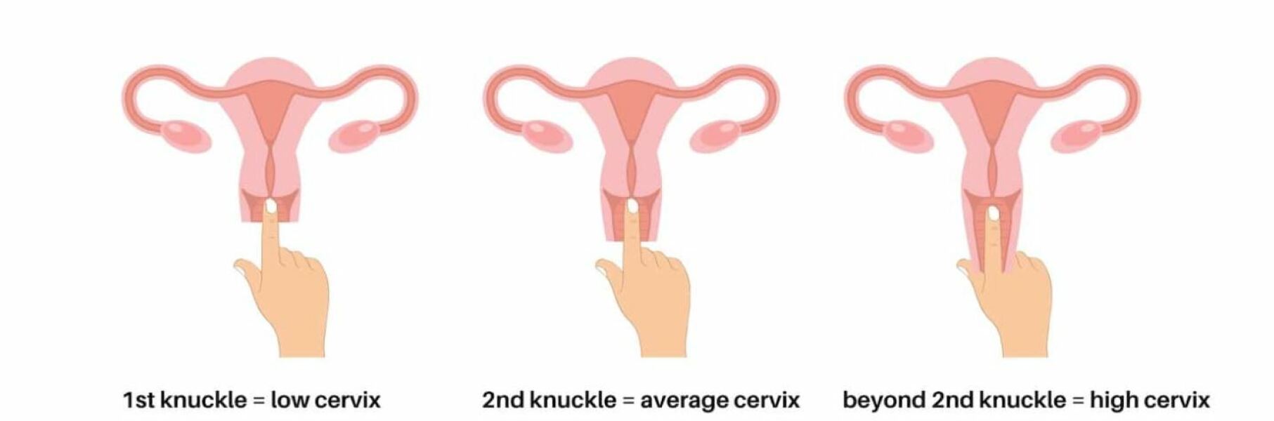 TTC after chemical pregnancy