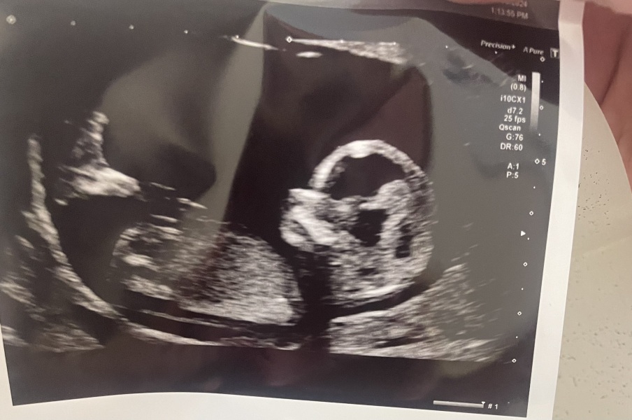 Boy or girl?