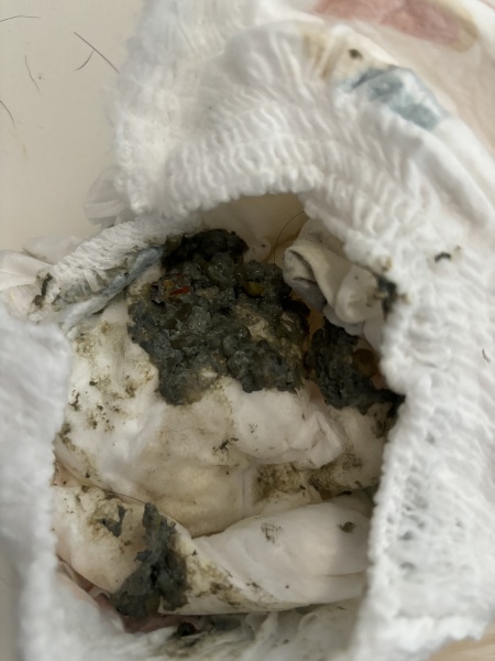 1 year old green poop