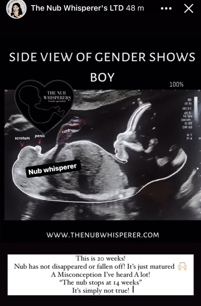 Have I ruined the gender surprise? :(