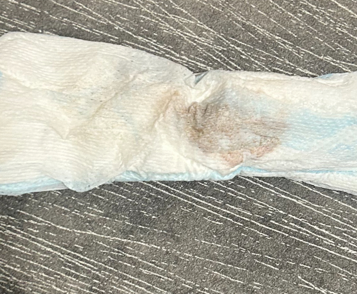 Could this be implantation bleeding??!