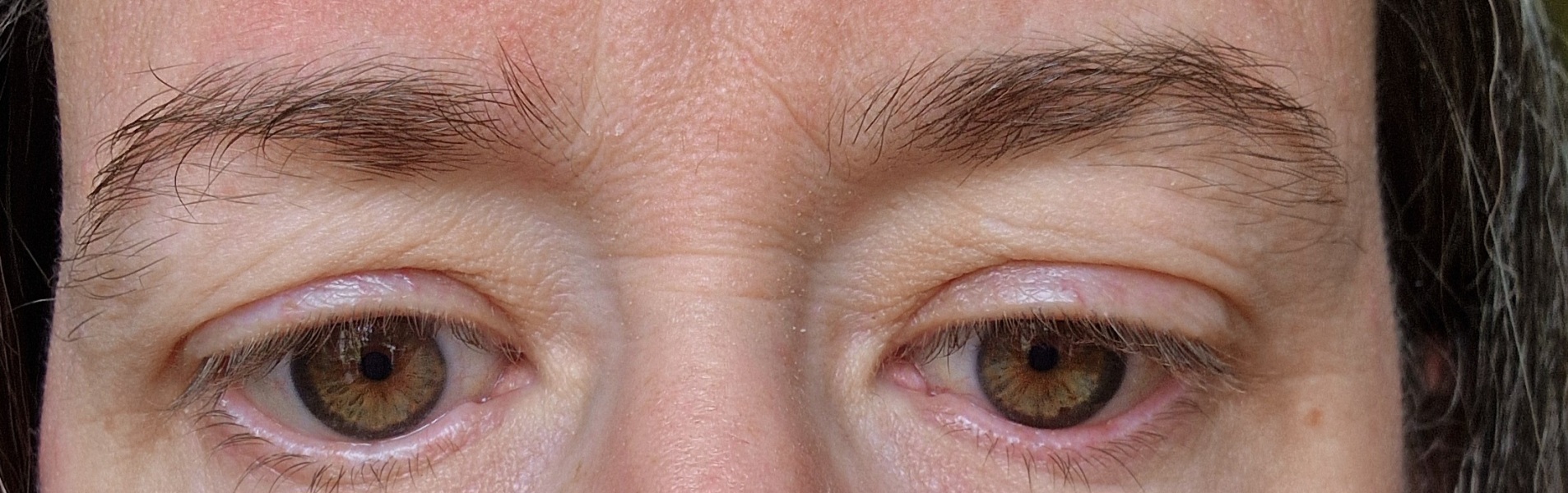 That mid-40s crepey wrinkliness around the eyes