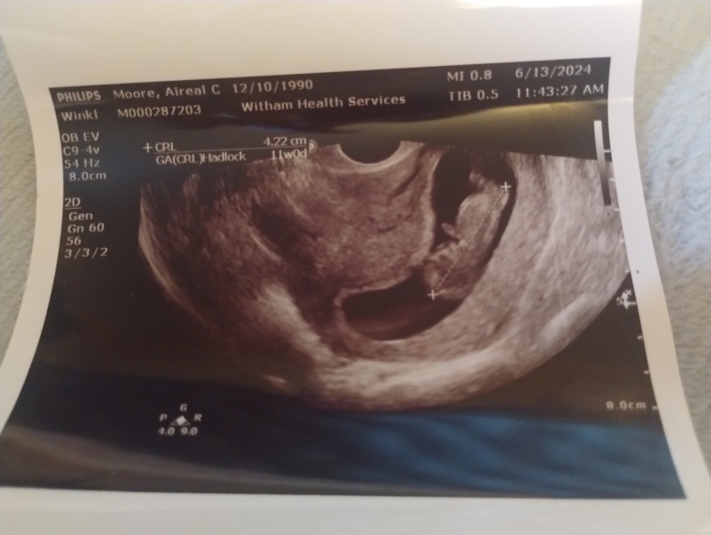 Boy or girl??