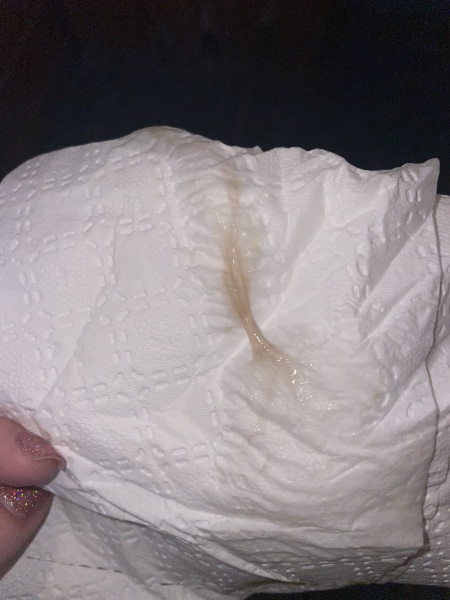 Implantation bleeding ? * warning picture included*
