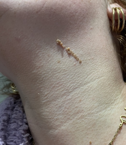 I was born with this. What is it?