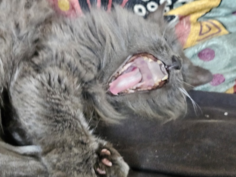 broken tooth