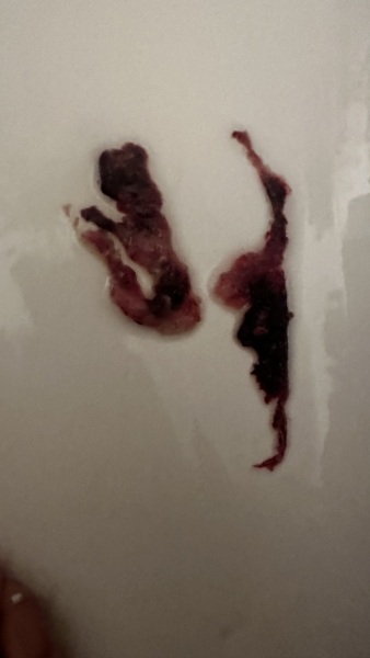 What is this? [Content warning: contains photo]