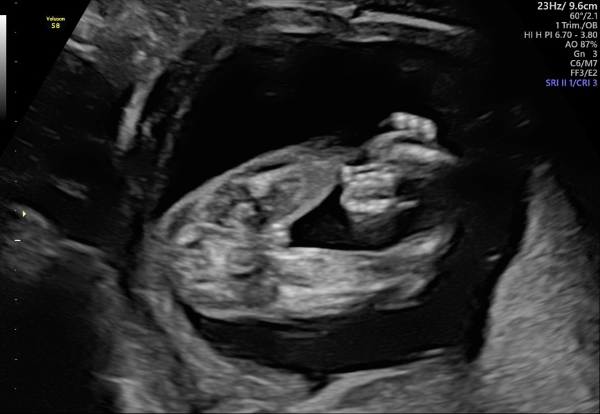 Boy or girl?