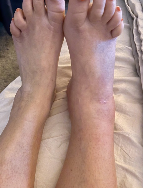Can I avoid a&e with this?