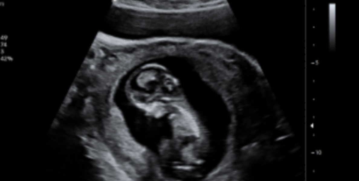 Guess the gender💖💙