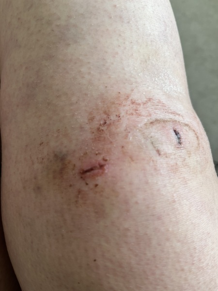 Is this infected?