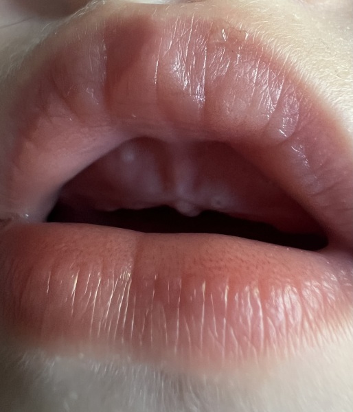 Does tooth look close ?