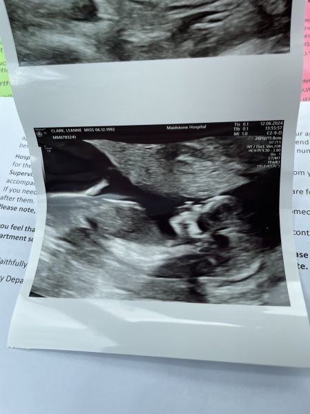 Nub theory/Gender guesses